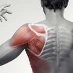 肩痛と循環不良の関係