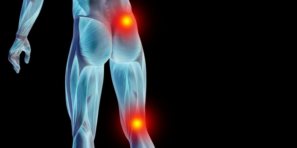 腰痛の原因は大腿骨内顆骨壊死！