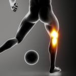 膝裏痛は関節の位置関係を直せ！